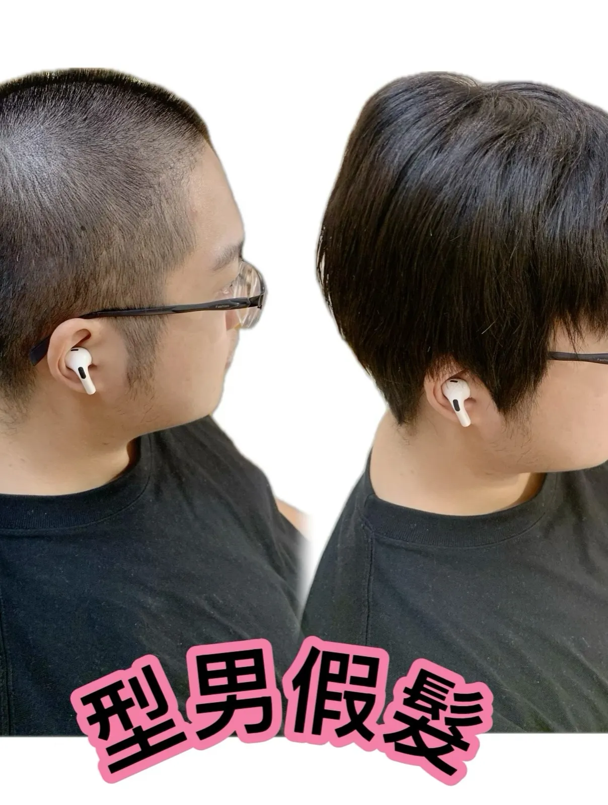 男士假髮｜型男假髮・側面對比 Before / After 對比照