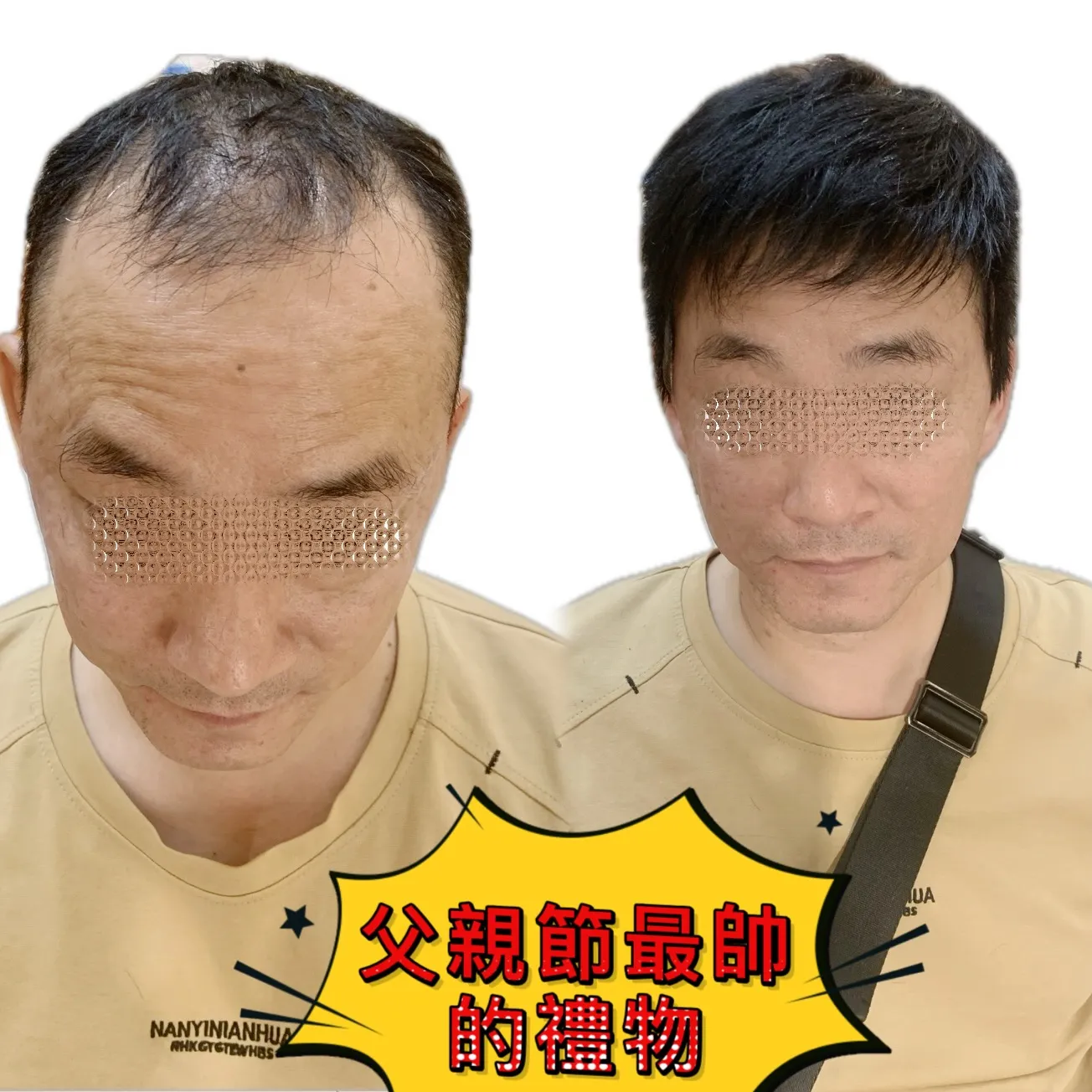 男士假髮｜父親節最帥的禮物・正面對比 Before / After 對比照