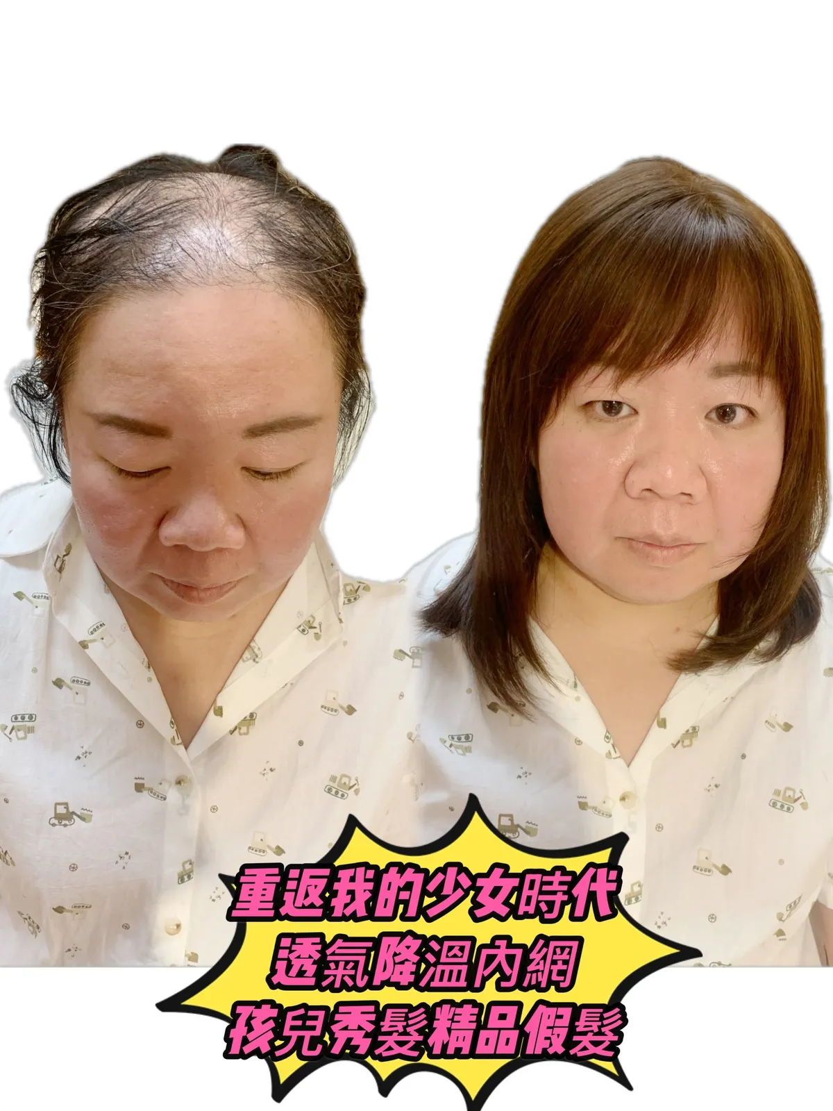 精緻假髮｜重現我的少女時代・透氣降溫內網 Before / After 對比照