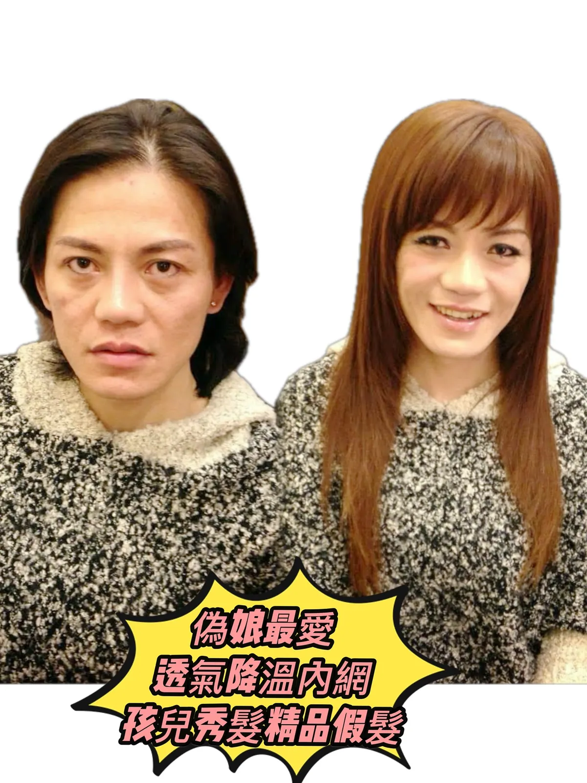 精緻假髮｜偽帽造型假髮・透氣降溫內網（正面） Before / After 對比照