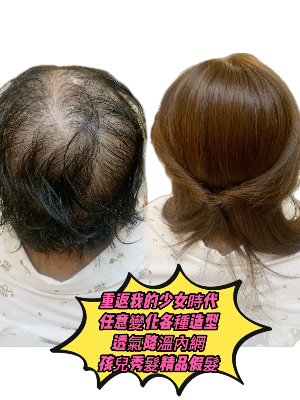 精緻假髮｜重現我的少女時代（後視） Before / After 對比照