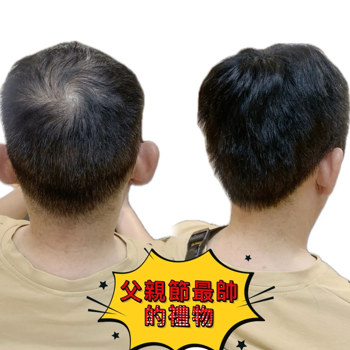 男士假髮｜父親節最帥的禮物・後視對比 Before / After 對比照