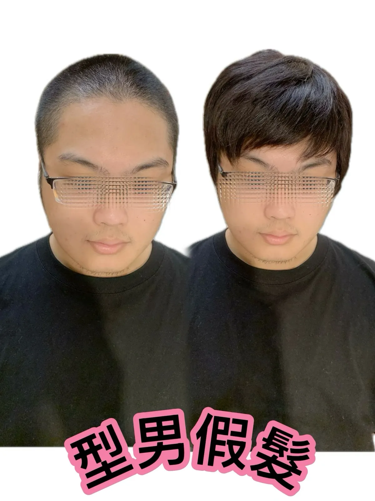 男士假髮｜型男假髮・正面對比 Before / After 對比照