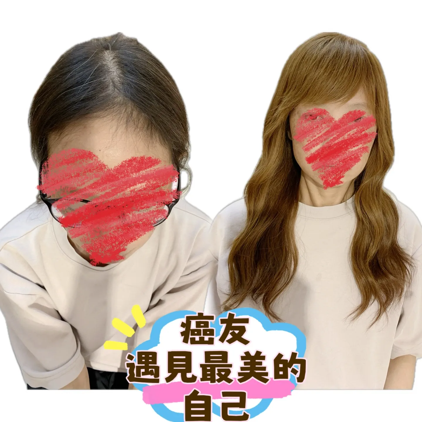 醫療級假髮｜遇見最美的自己・正面對比 Before / After 對比照
