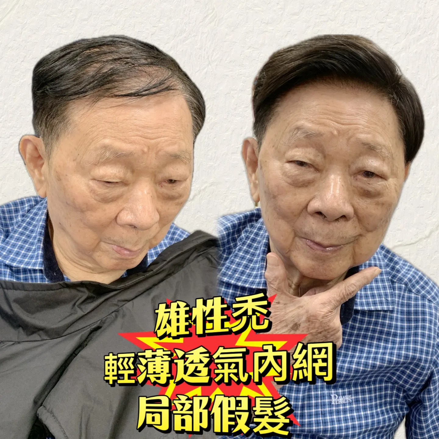 男士假髮｜雄性禿・輕薄透氣內網・局部假髮 Before / After 對比照